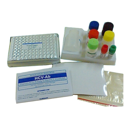 গবেষণা ডায়গনিস্টিক Hbsag Elisa কিট গুণগত এনজাইম Immunoassay মানুষের ব্যবহার